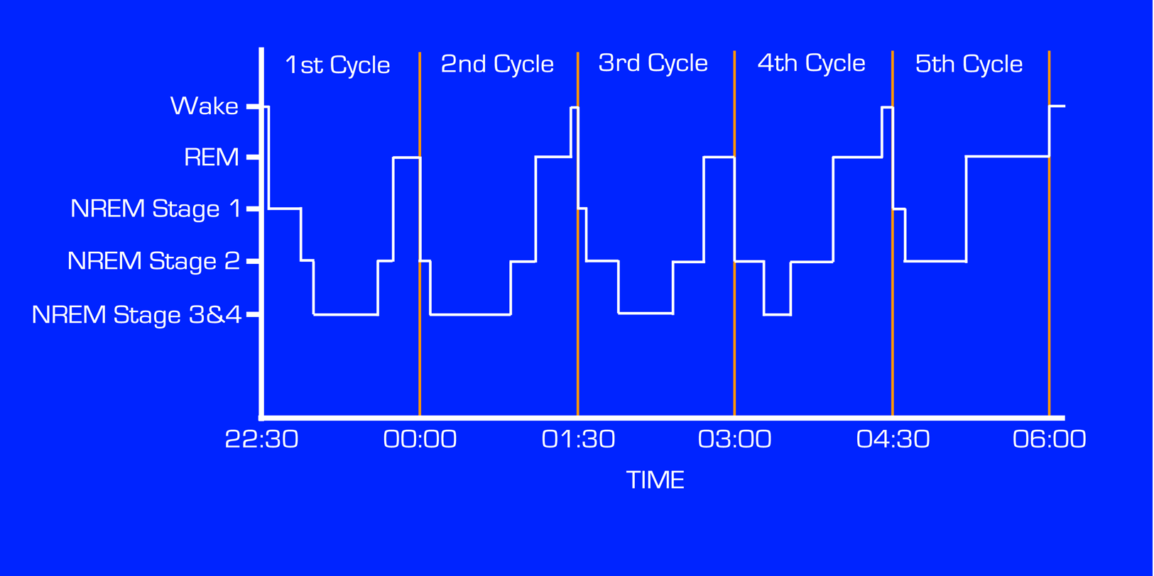 A Sleep Cycle Hypnogram