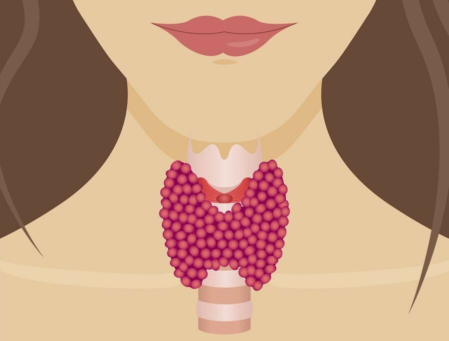 Diagram of a woman showing the location of the thyroid.